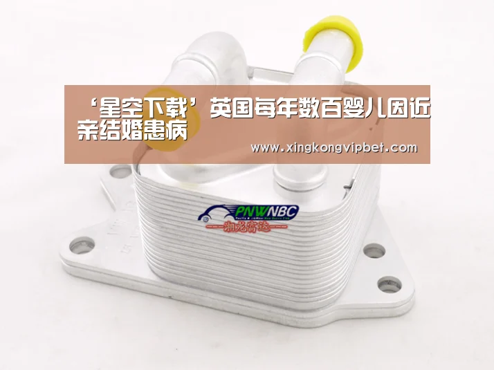 ‘星空下载’英国每年数百婴儿因近亲结婚患病(图3) 星空平台